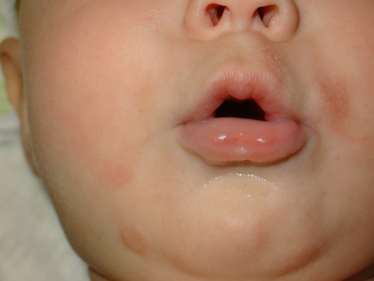 Девочки, что это?