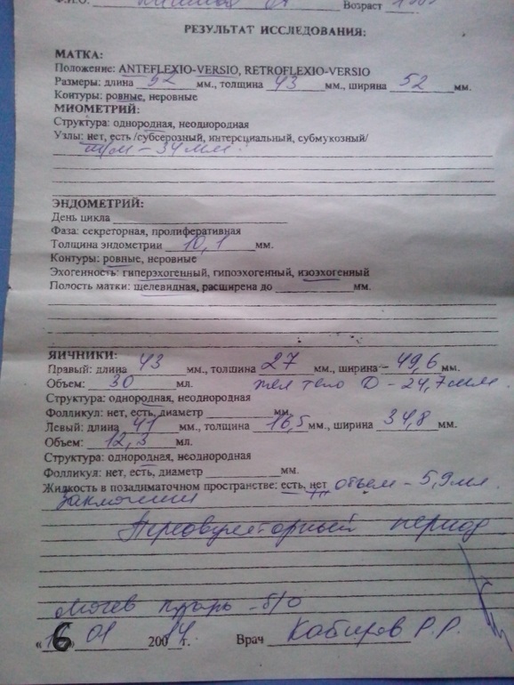 Девочки!!! Моё узи!!