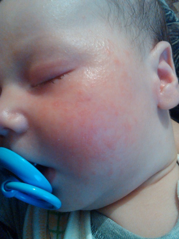 Девченки,что это???