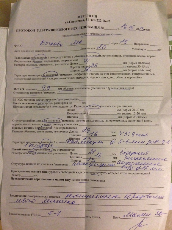 пришло мое узи....даже не знаю плясать или все же стоит погрустить....