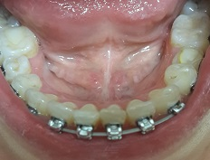 9 месяцев спустя