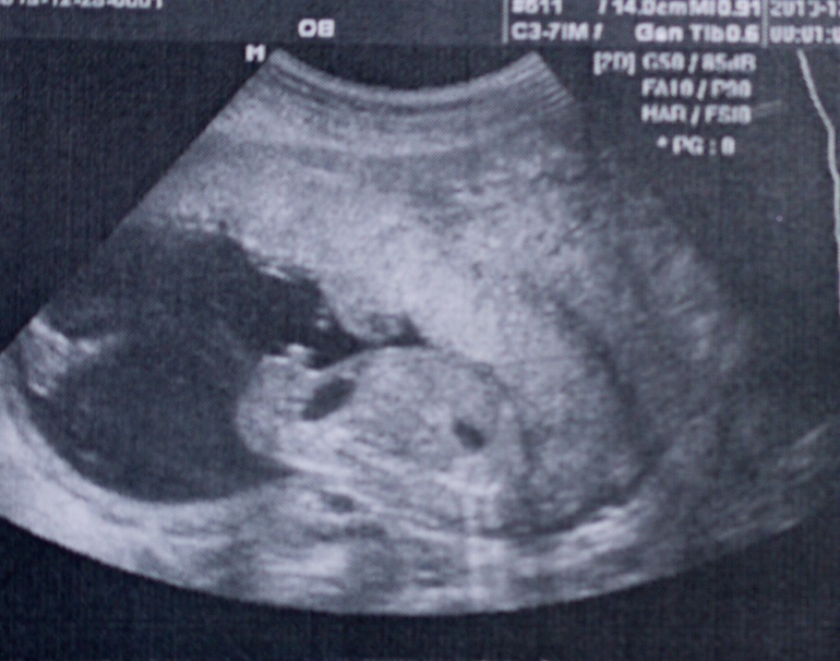 Мой второй экватор