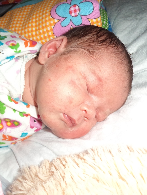 Обострение ...