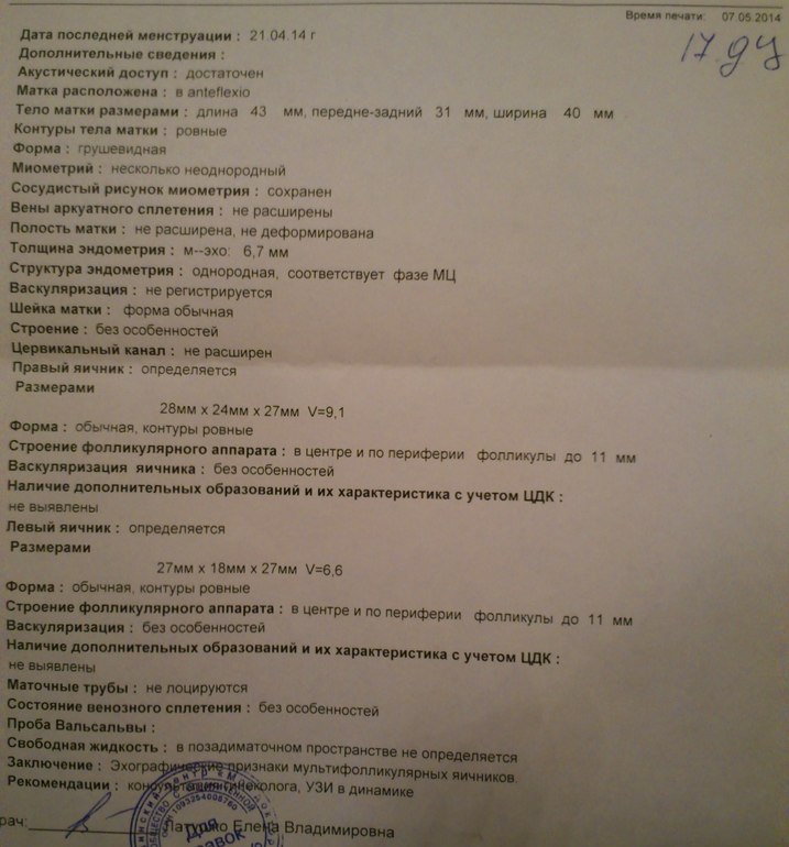 Май, давай, до свидания! или как я сходила на УЗИ...