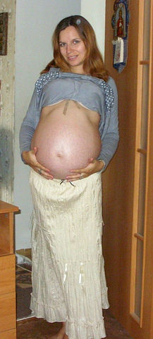 Роды №3 Кс