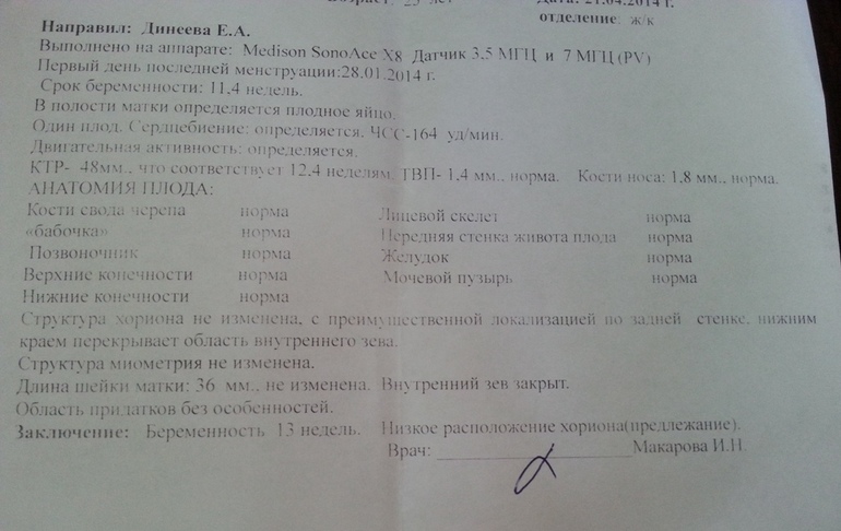 Мой первый скрининг!