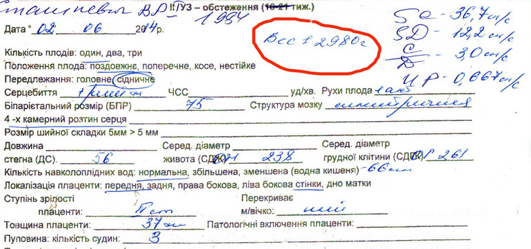 Вес плода на 30й неделе.