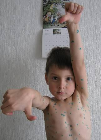 Леопёрдик