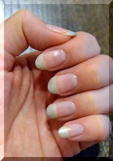 Рост ногтей