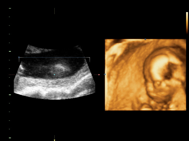 Ура! У нас в домике МАЛЬЧИК!