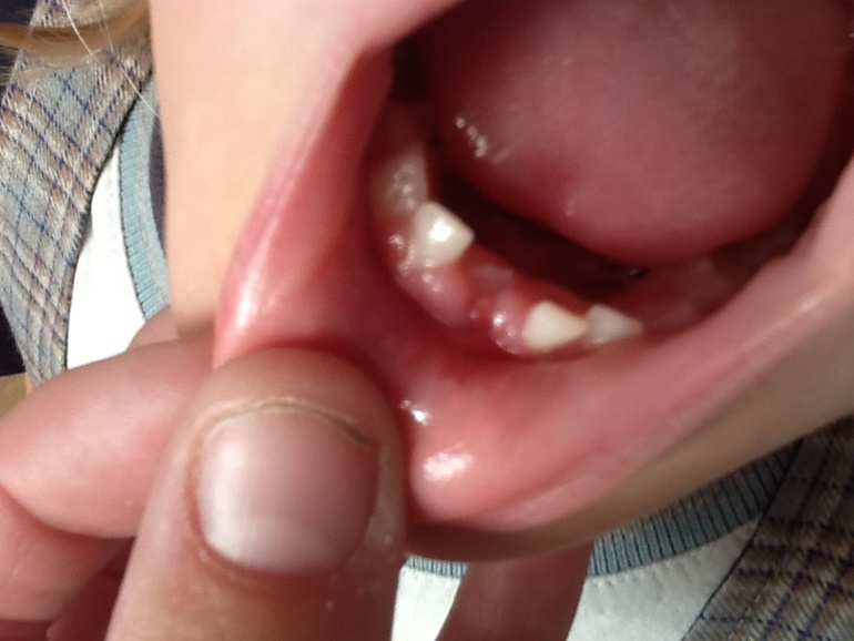 Растет неровно