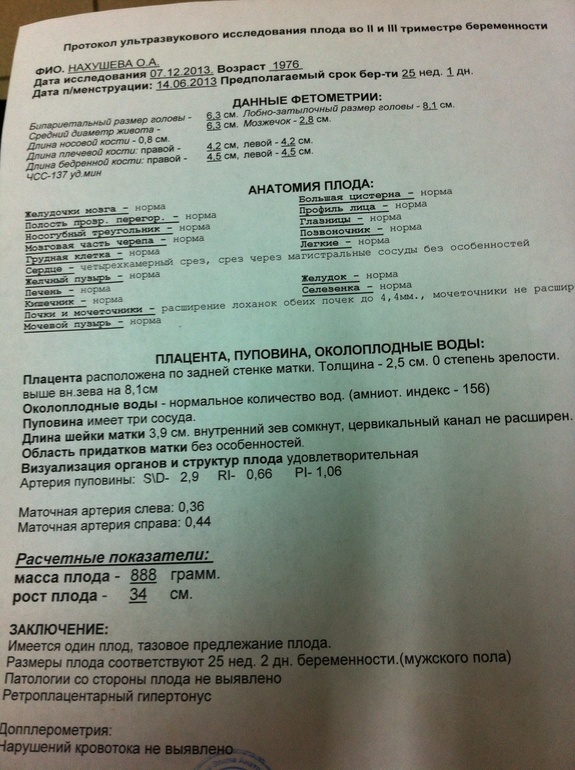 Узи