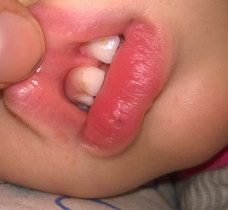 ждать или не ждать...