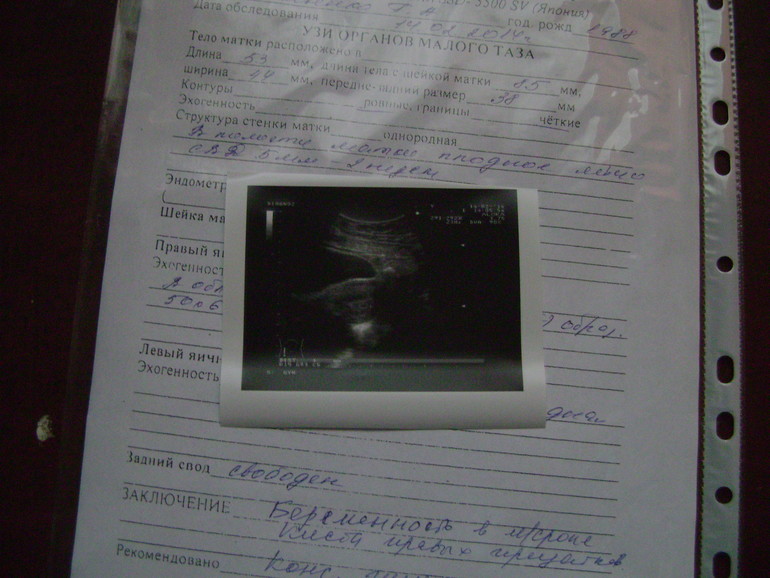 у нас получилось)))