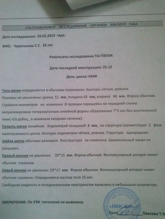 УЗИ