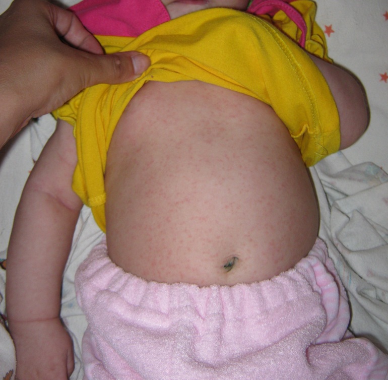 Сходили мы в больницу.