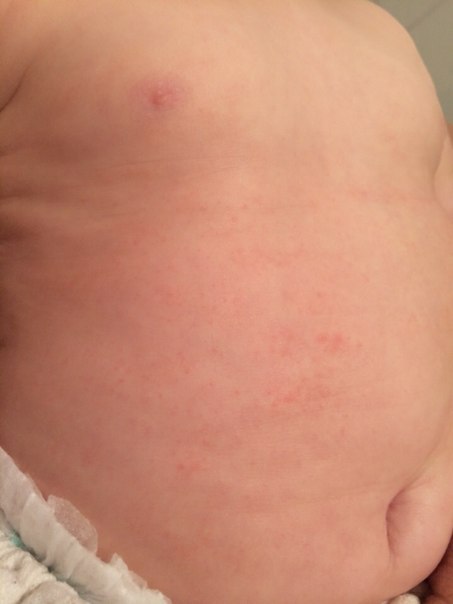 Девочки помогите...сил нет