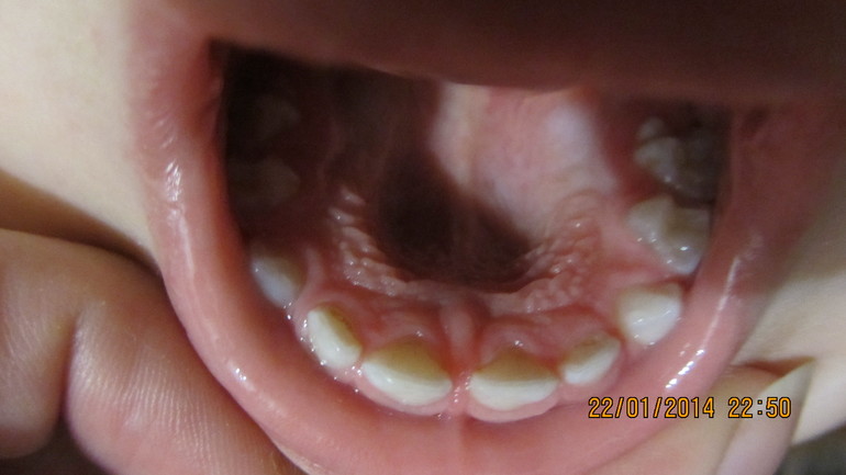 Как лечить?