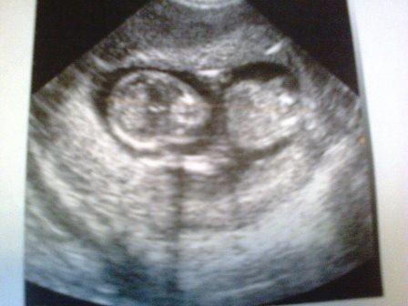 Нам уже 13 неделек))