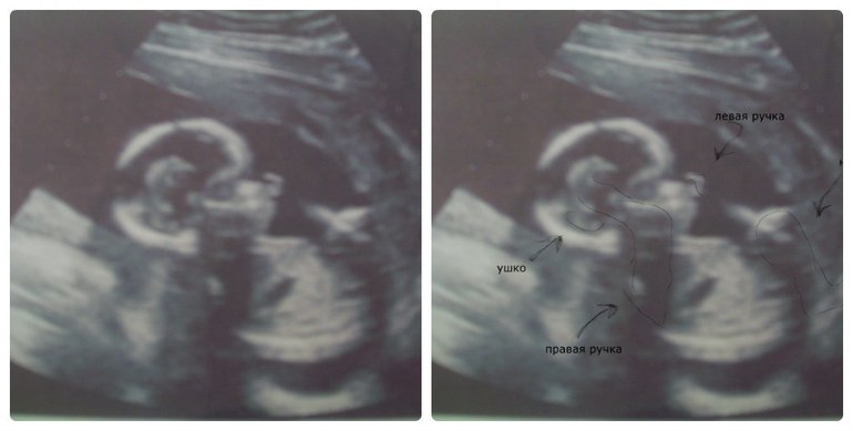 Покажу вам малышастика своего))