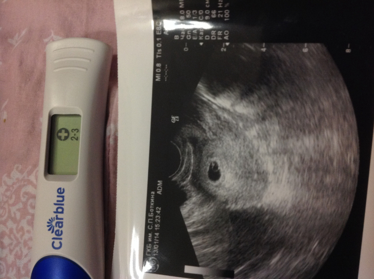 Наконец-то нас четко увидели!!!)