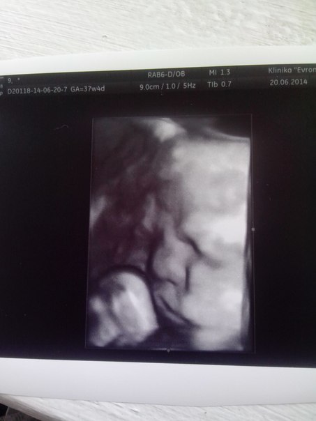 ))))) фоточки