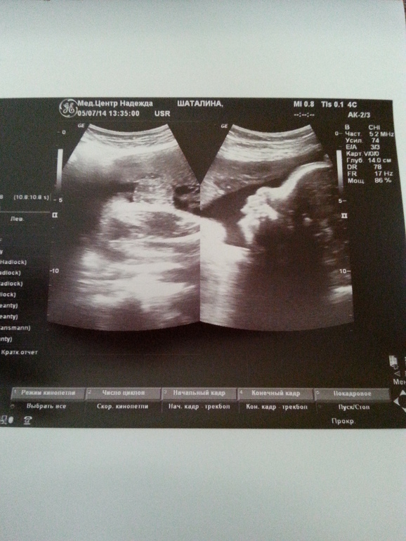 32 недельки)))