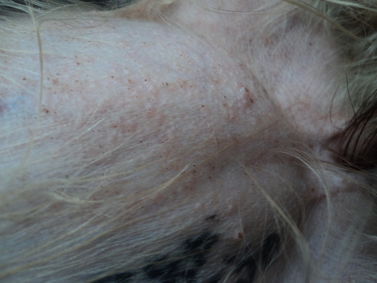 сыпь у йорка