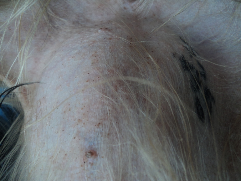 сыпь у йорка