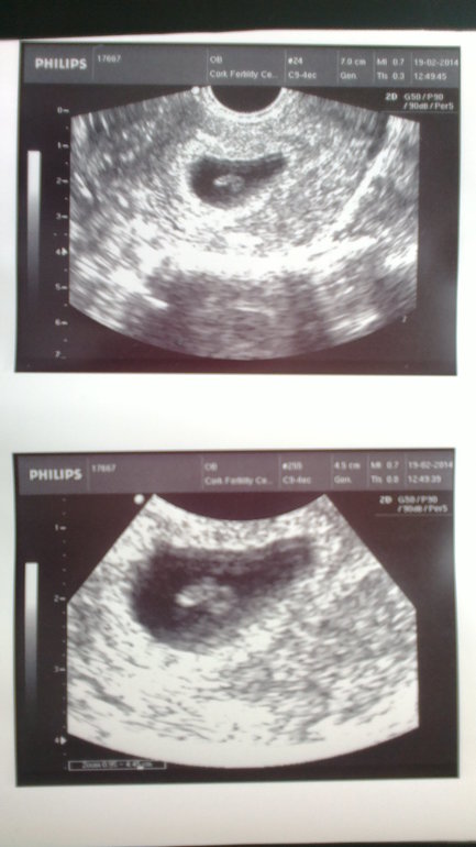 Мои 8 неделек