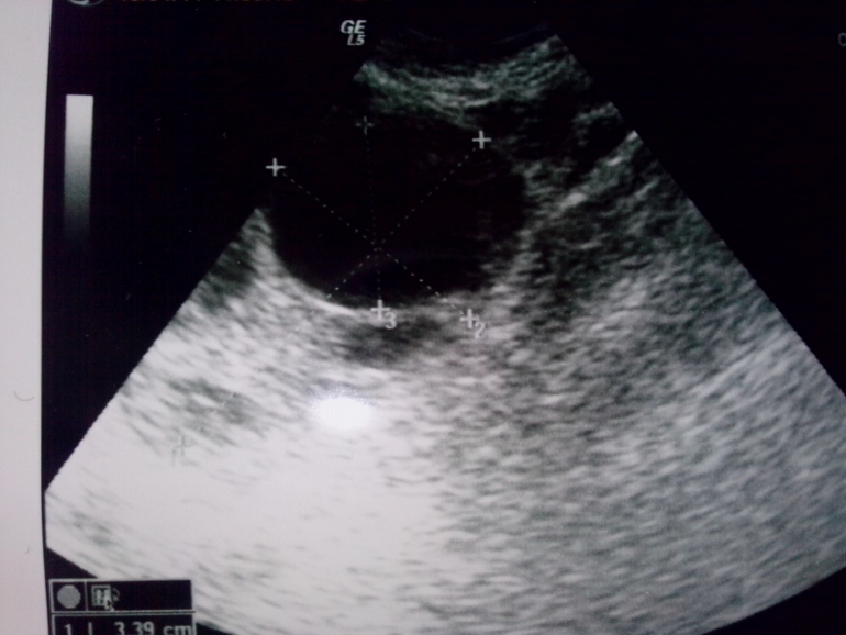 Ничего не понимаю, вторая О на горизонте?