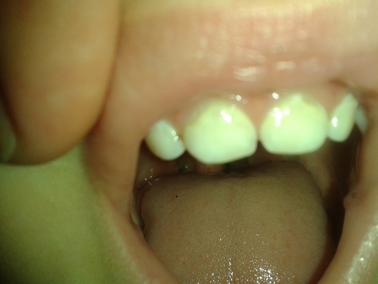 что делать??!!??