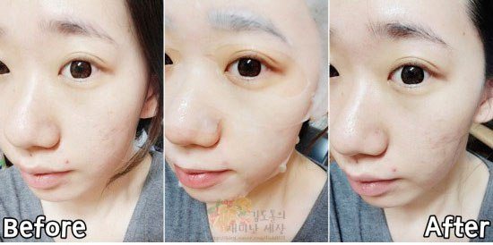 Свотчи YADAH Anti-T Mask - маска для проблемной кожи