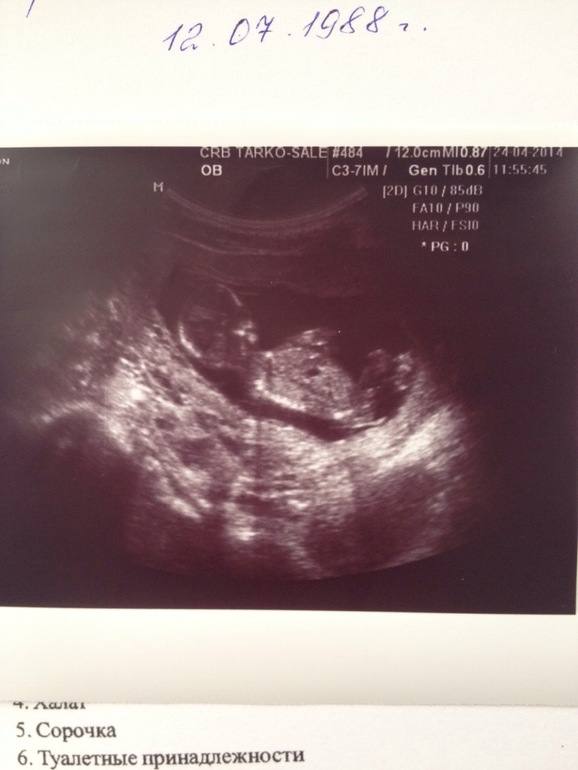 Девочки, не видно кто будет?