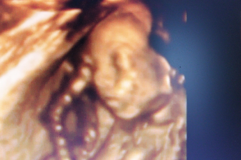 УРРРРАААААААААА!!!!!!!!!!! УЗИ в 21 неделю)))))))