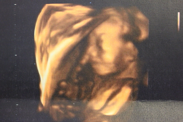 УРРРРАААААААААА!!!!!!!!!!! УЗИ в 21 неделю)))))))