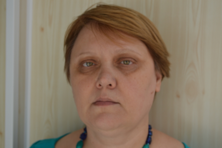 У меня уголки губ вниз У меня уголки губ вниз
