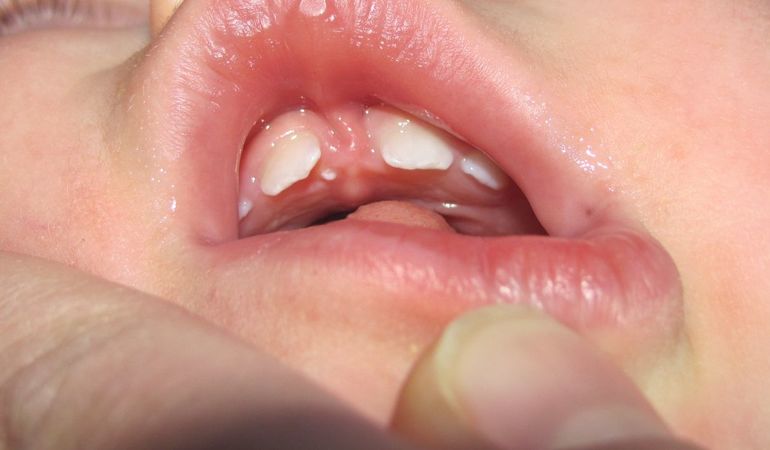 Сфотографировала.