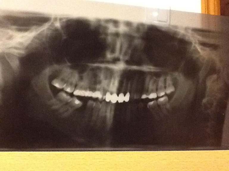 Доброй ночи,это снова я