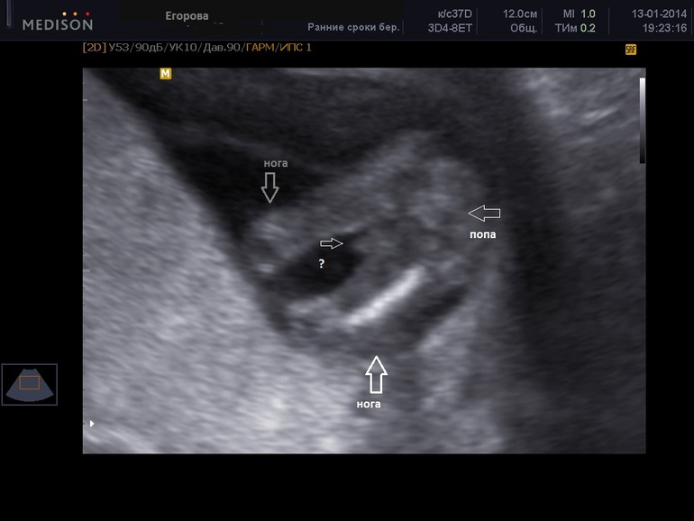 Как вы думаете кто это?