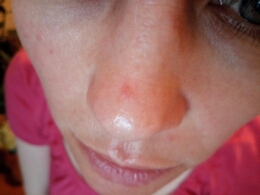 что с моим носом??