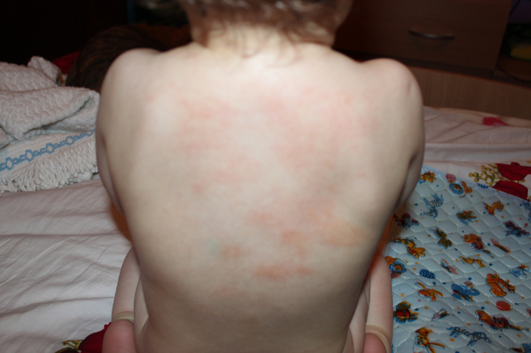 Мы все про свои пятна...не можем выявить от чего...Help...