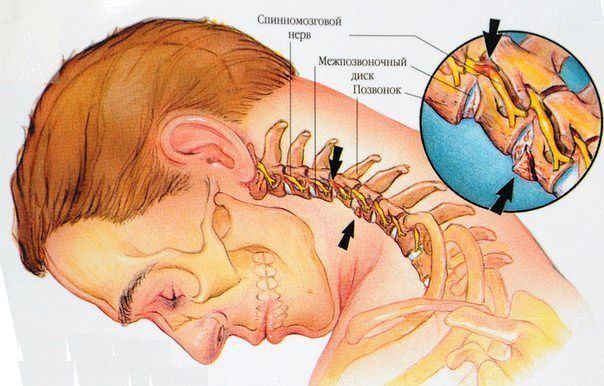 ЗЕРКАЛА, ТЕХНИКА И ТРАВМЫ ШЕИ