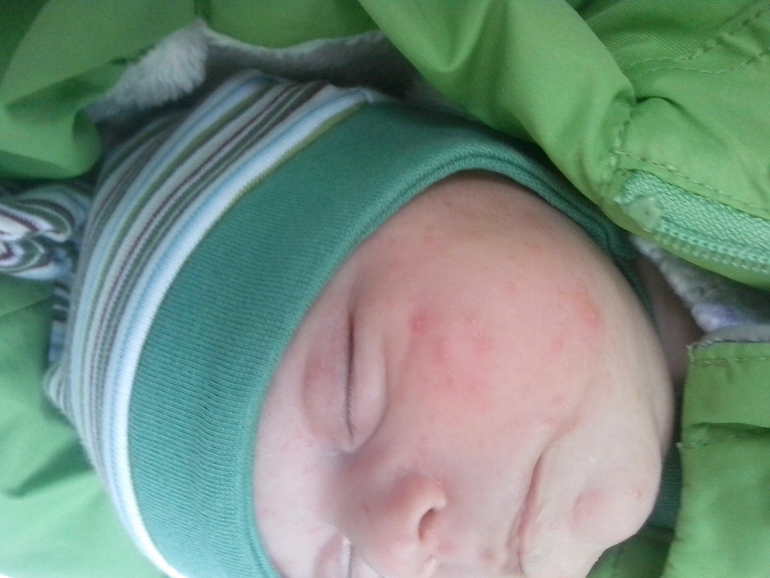 Аллергия или фиг знает что!?