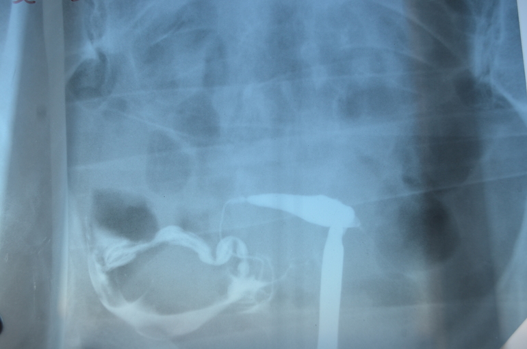 Результаты МСГ