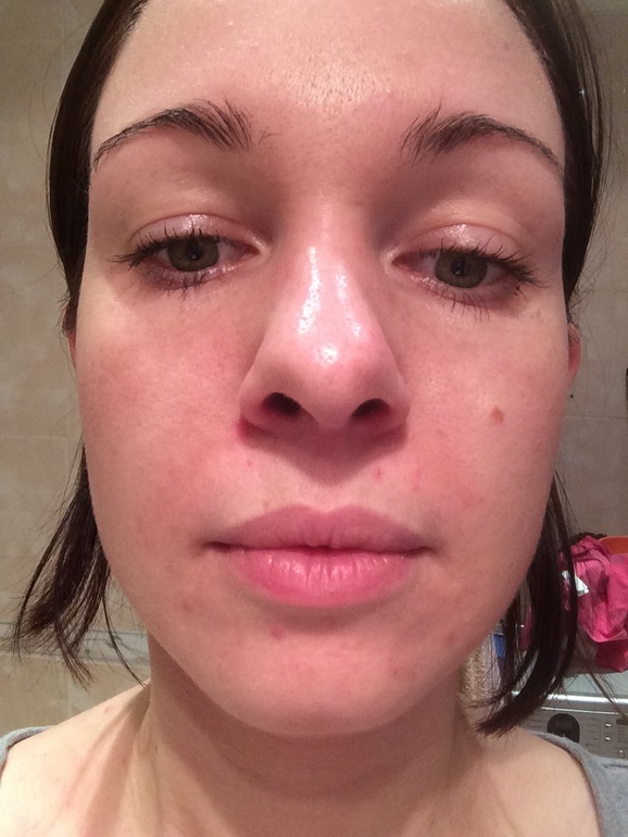 Закончила уход!