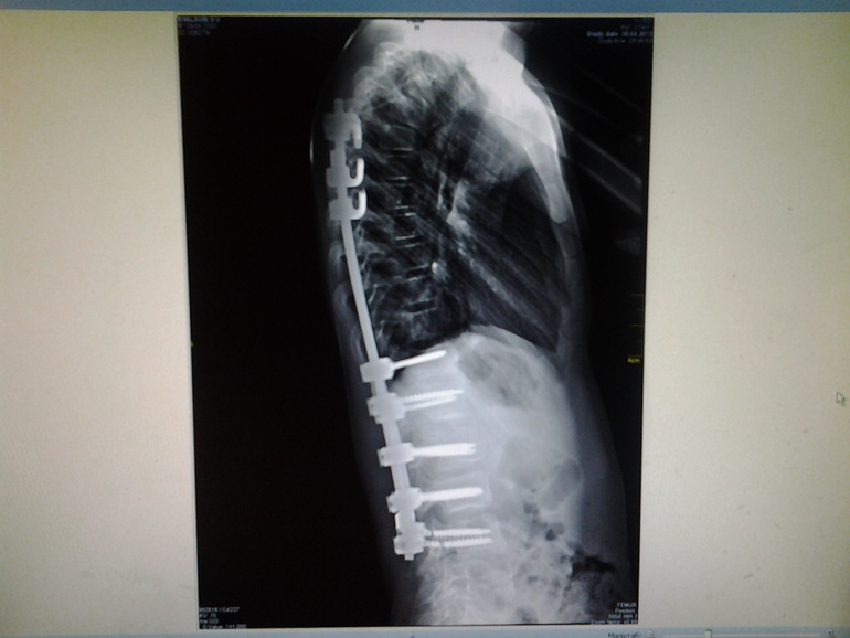 Наши новые снимки!Шурупы то на месте!!!