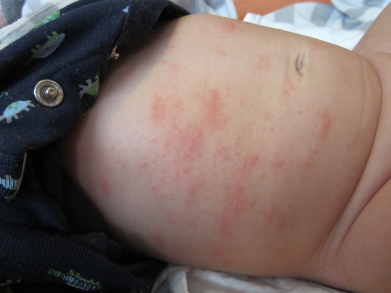 рацион кормящей мамы