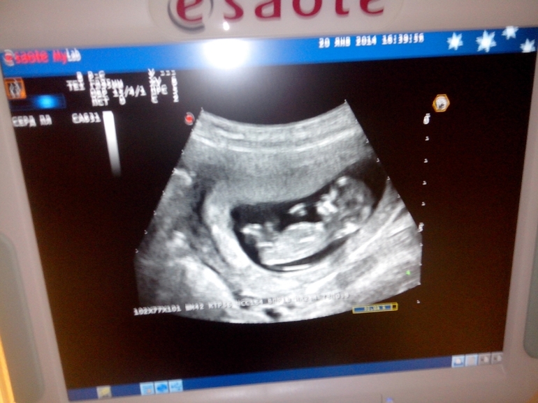 Наш 1-ый скриниг! Моя любимая детка, моя радость, моя жизнь!!!!!