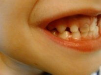 Почернел резец после удара